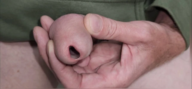 Üretral oyuncaklar ve işerken açık çiş deliği