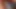 Viral