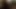 Pickedup ırklararası bebeğim analized ve iğne yapmak