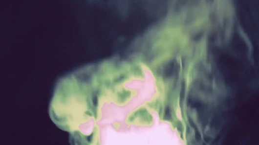 Bekaret inhalanları anal