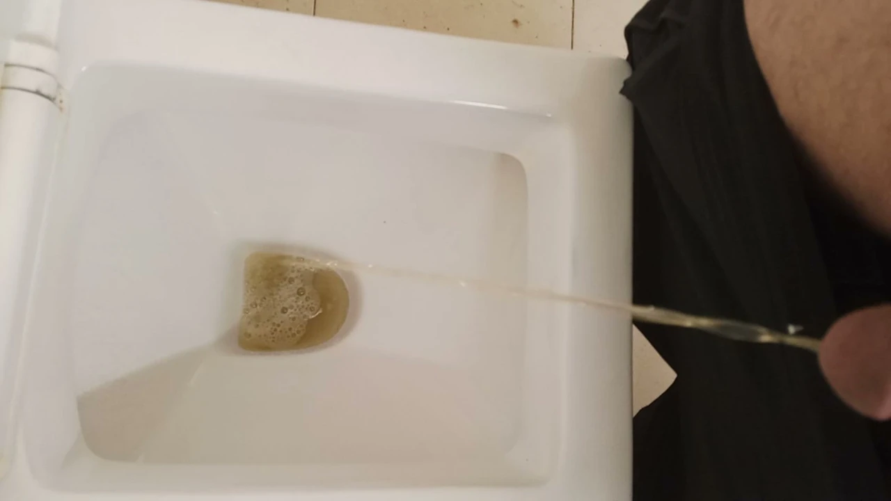 Bu çocuğun çok sidiği var