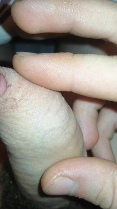 18 yaşında peynirli küçük penis (smegma)