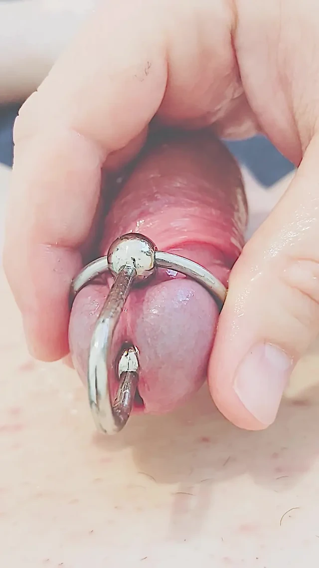 El işi ve üretral dilatasyon