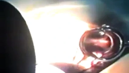 Zhangjiajing hemşireler Tayvan Tayvanlı hemşireler hizmetçi yapay penis(3