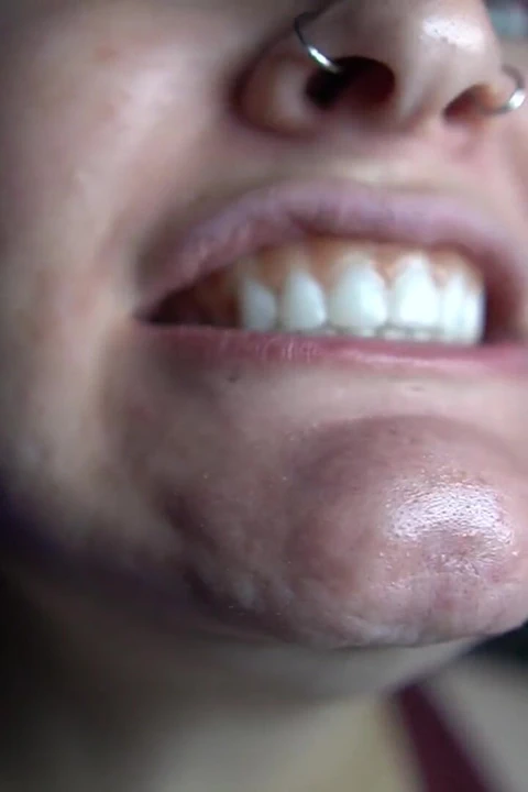 Takma yarakla ağız turu