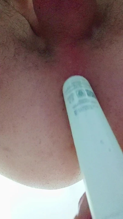 Anal, sokma