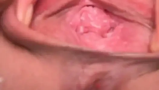 Köle S Labiasını Dikiyor