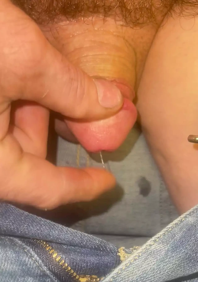 Minik yarakların aşka ihtiyacı var