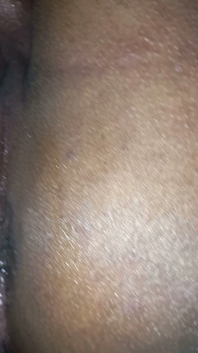 Tıraş sonrası kıçım