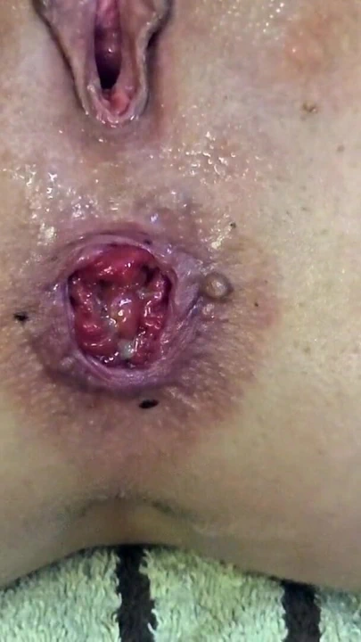 Sırp rap müzik videoları. Sırp amatör anal delik genişletme vol.5 | Klip 2