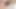 Close-up video of an Asian boy's huge foreskin