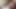 Bangalore özel doktor evde seks hoşlanır