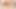 Stefie'nin sperm deliği için grup dolgusu