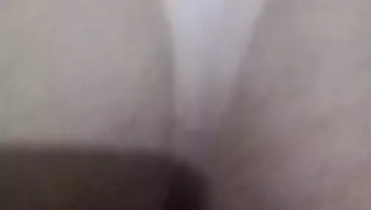 Şu bronzlaşma çizgisi