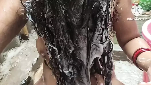 Kayınbiraderi dengue