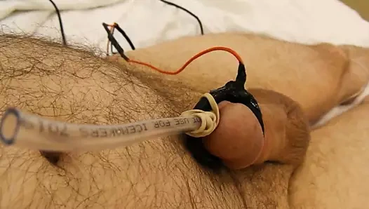 boşalmak kateter ile elektro