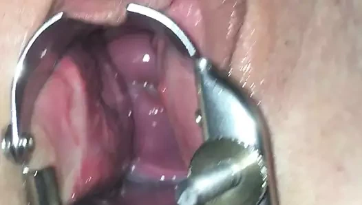 Spekulum ve serviks oyun