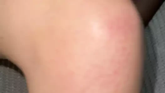 Çıplak bacaklara meyve suları sürtmek