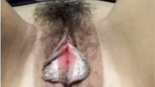 Labia küçültme kaydırağı