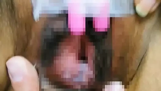 M köle çarkı, pin tekerlek zevki