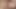 anal