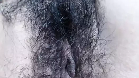 Diş telleri ile kıllı Meksikalı