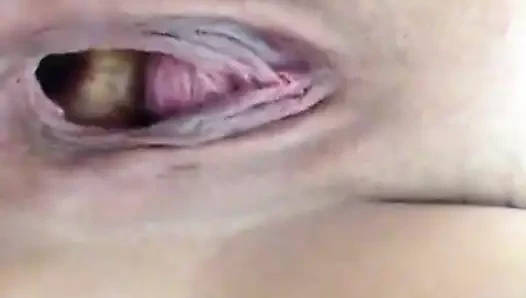 Drap cezalandırdı! gezimde çantamı unuttum