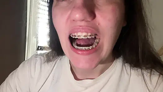 Dilinizle diş teli yalamak