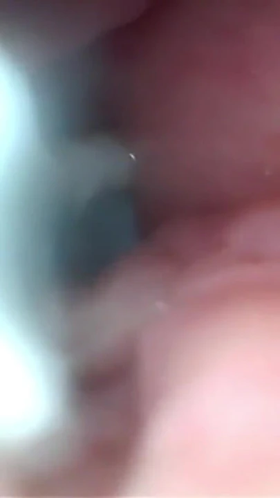 Serviks geniş esneyen amcık endoskopunda sperm! | Klip 1