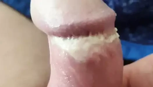 strumpfmann Smegma am mini Pimmel