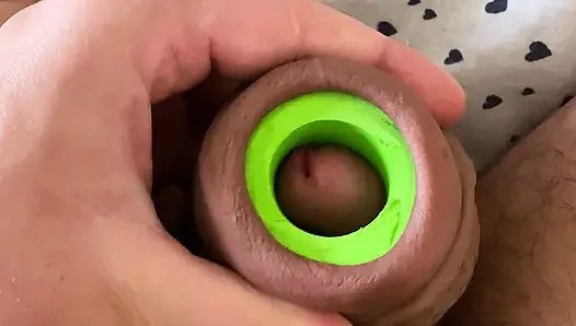 Şişme sünnet derisi esnetme