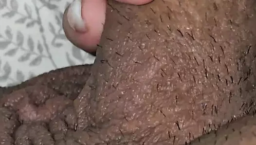 Üvey anne büyük yaraklı üvey oğlundan uzak duramıyor