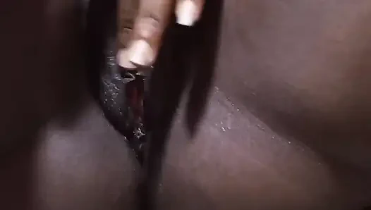 Parmaklama ve fışkırtma