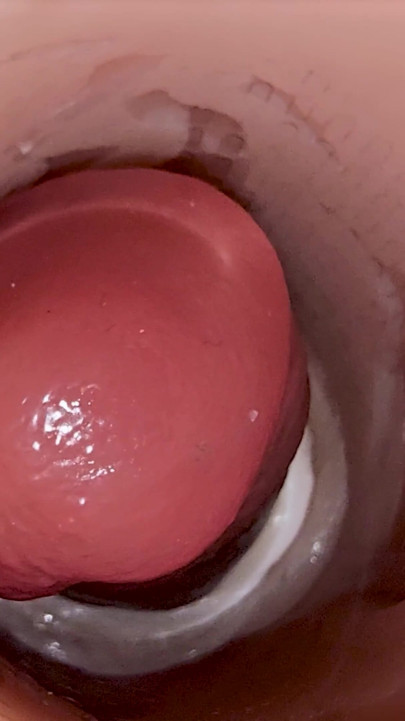 Camera inside deep pussy captures huge ejaculation of sperm | Clip 2