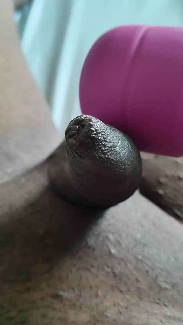 Sünneti altında küçük yarak