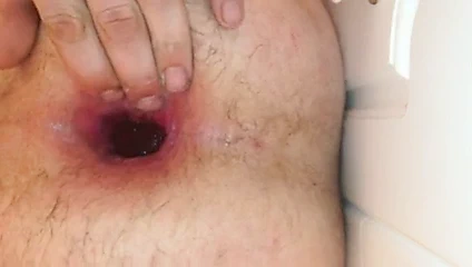 Tüm götten sınıf yok