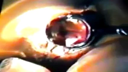 9)zhangjiajing hemşireler hizmetçi yapay penis hemşireler tayvan Tayvanlı