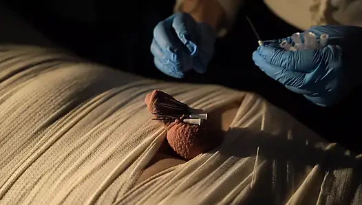 Tıbbi oyun eğlencesi, mumyalama, iğne cbt ve elektro