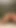 Anal