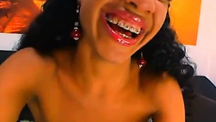 Jeb Amca - diş tellerini seviyorum!