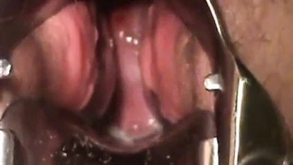 Bbw mastürbasyon yapmak ile spekulum gösteri serviks sözleşme orgazm