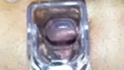 Yayılıyor onu am yakın yukarı ve spekulum oyun