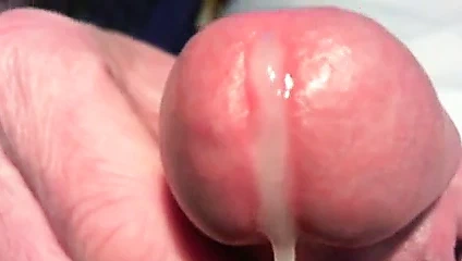 Sikimden çıkan sperm, çok yakından .2