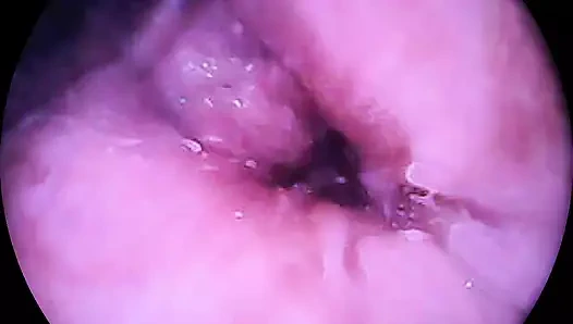 Amcığımdaki kamera