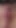 If You Like Butthole and Pussy Spreading Accidental Queefing This One's for You