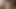Schnellspritzer: Quicky 1