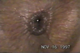 Karım anüsüne yumurta koyuyor...