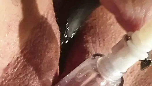 Klitoris vakum emmek