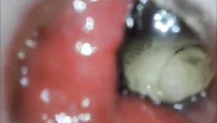 Anal endoskop eşek oyun itibaren içeride