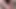 Komşunun kızı sünnet derimle oynuyor